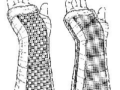 Acilde kullanılan atel çeşitleri