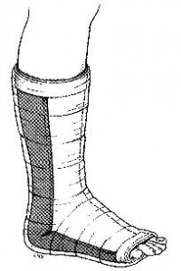 Kısa bacak posterior atel