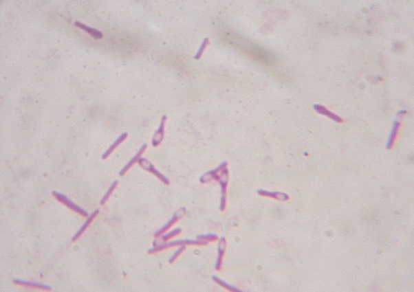Clostridium-botulinum