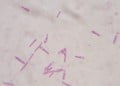 Clostridium Botulinum Nedir?