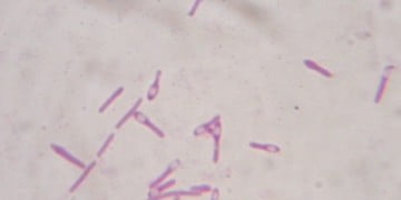 Clostridium Botulinum  Nedir?