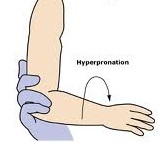 hiperpronasyon
