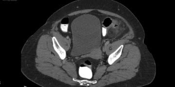 Batın Tomografisi Soruları 001