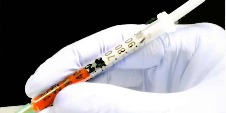 Kan gazı nasıl değerlendirilir ?