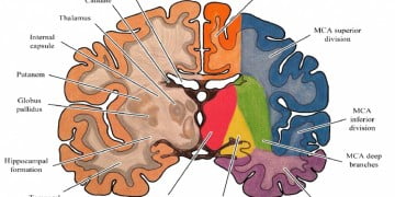 İskemik inme ve hemorajik inme sendromları