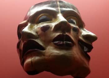 Travmatik Subdural Hematom