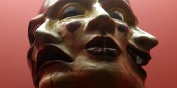 Travmatik Subdural Hematom
