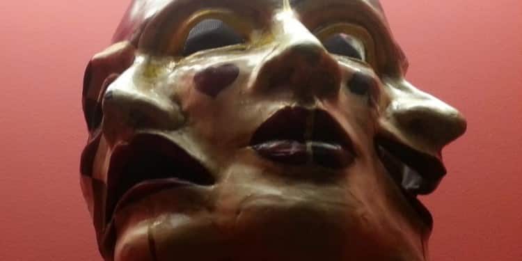 Travmatik Subdural Hematom