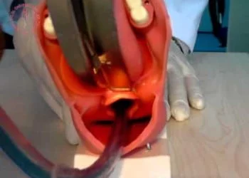 Endotrakeal Entübasyon
