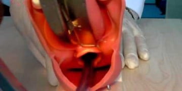 Endotrakeal Entübasyon