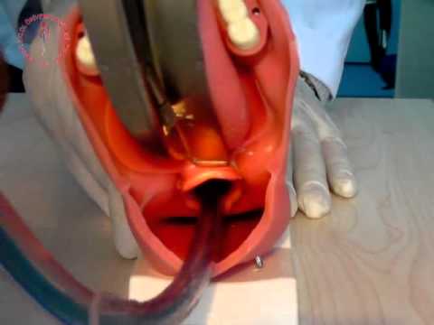 Endotrakeal Entübasyon