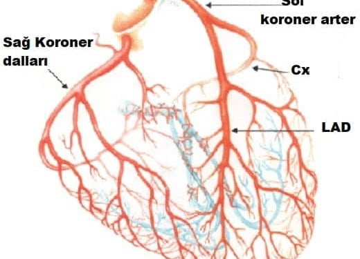 Miyokard enfarktüsünün EKG lokalizasyonu