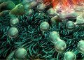 Lyme Hastalığı Nedir?