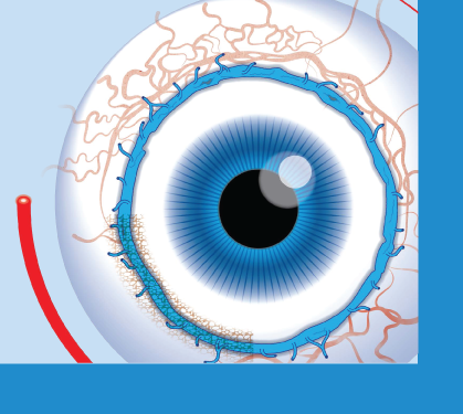 Oküler karın ağrısı