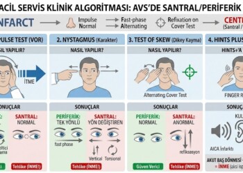 Vertigo ayırıcı tanısında MR’dan bile daha etkin diyebiliriz: HINTS